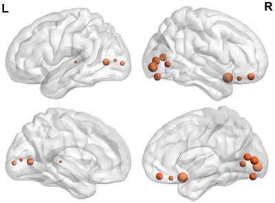 The body mass index is associated with increased temporal variability of functional connectivity in brain reward system